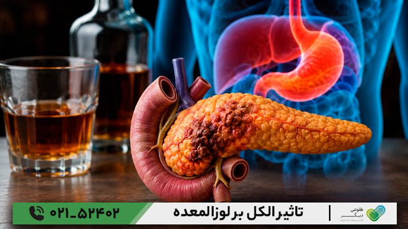 تاثیر الکل بر لوزامعده