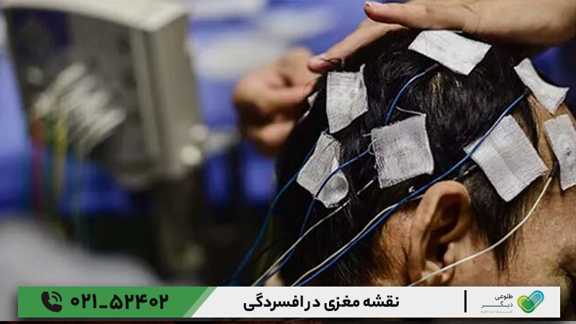 نقشه مغزی در افسردگی