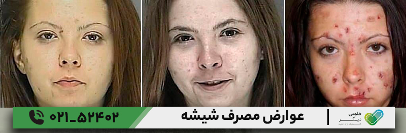 عوارض مصرف شیشه