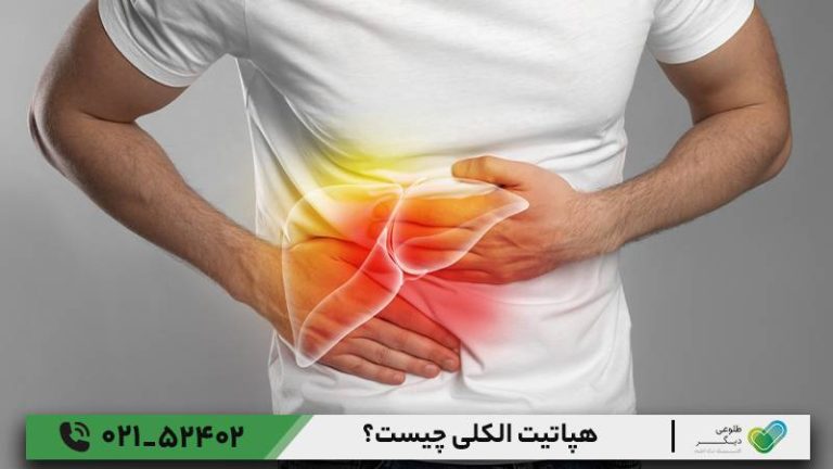 هپاتیت الکلی چیست؟